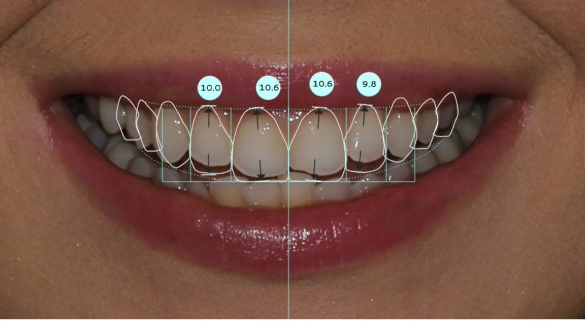 Dijital G&uuml;l&uuml;ş Dizaynı